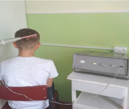 Дарсонвалізація